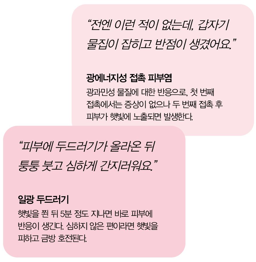 광과민성 피부 질환 설문 조사