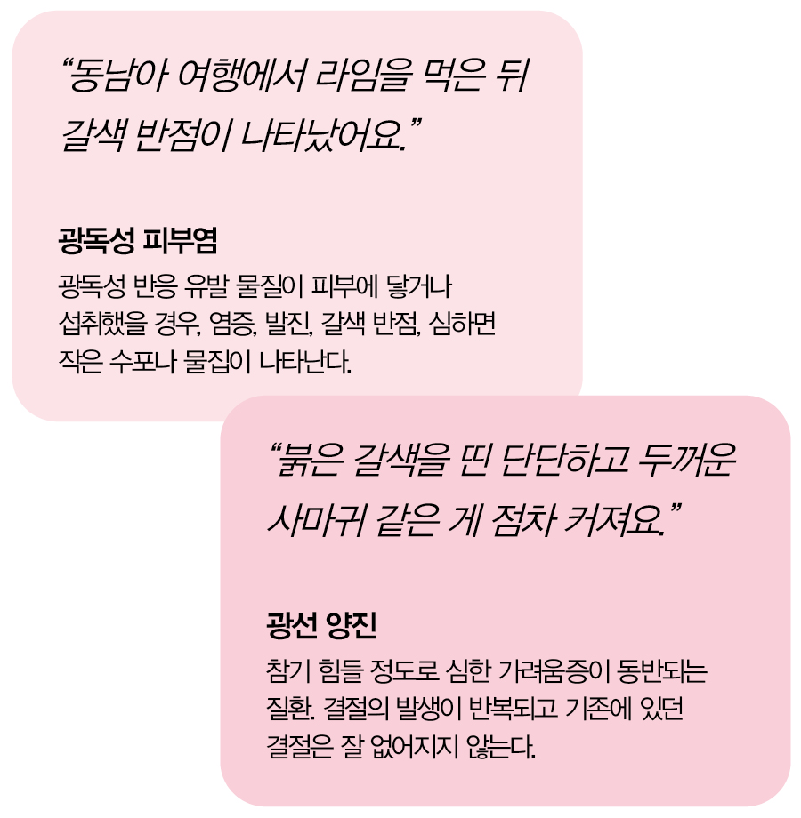 광과민성 피부 질환 설문 조사