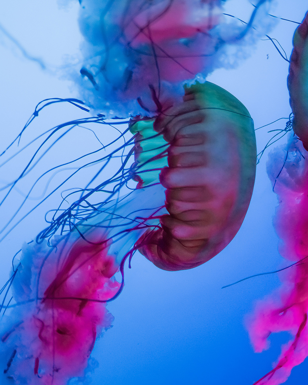 해파리 쏘였을 때